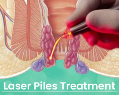 Piles Treatment