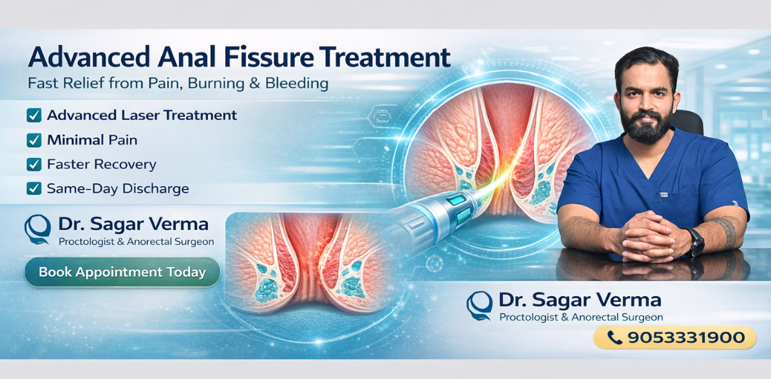 Anal Fissure Treatment
